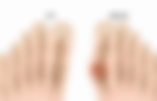 秋在镐院长（韩国）的真实实例