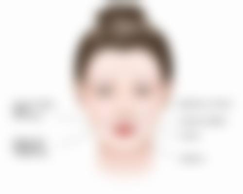 南通英莎医疗美容门诊部李辉做医美项目的安心性如何