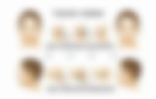 适合疤痕疙瘩化脓治愈的医美项目有哪些