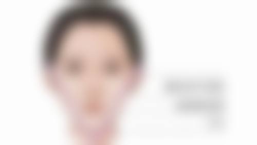 遗传因素导致黑眼圈还有眼袋怎么办