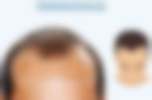 刘大伟医生的荣誉资质
