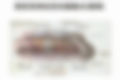 怎样快速去除眼袋淤青？试试这5种医美方法，激光、填充等高效改善，还你明亮双眼！ 