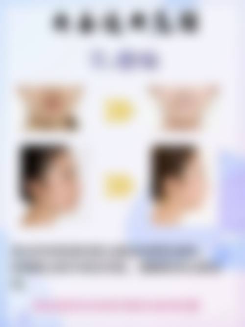 埋线双眼皮术后休息护理适合吗