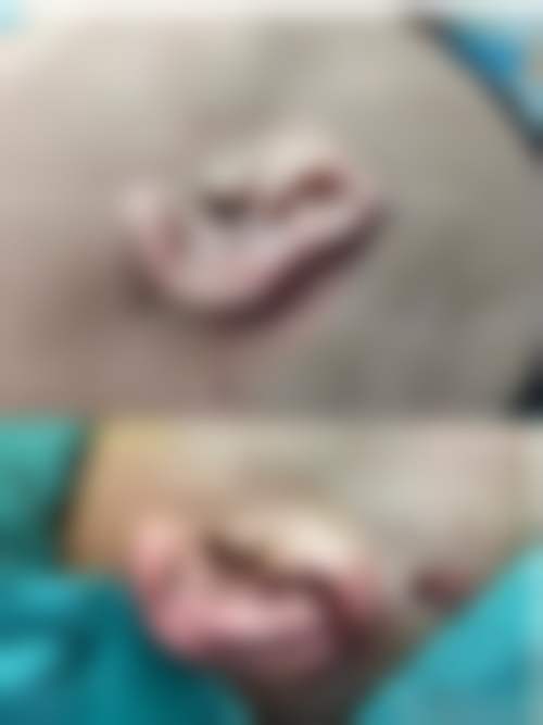 徐俊峰医生真实实例