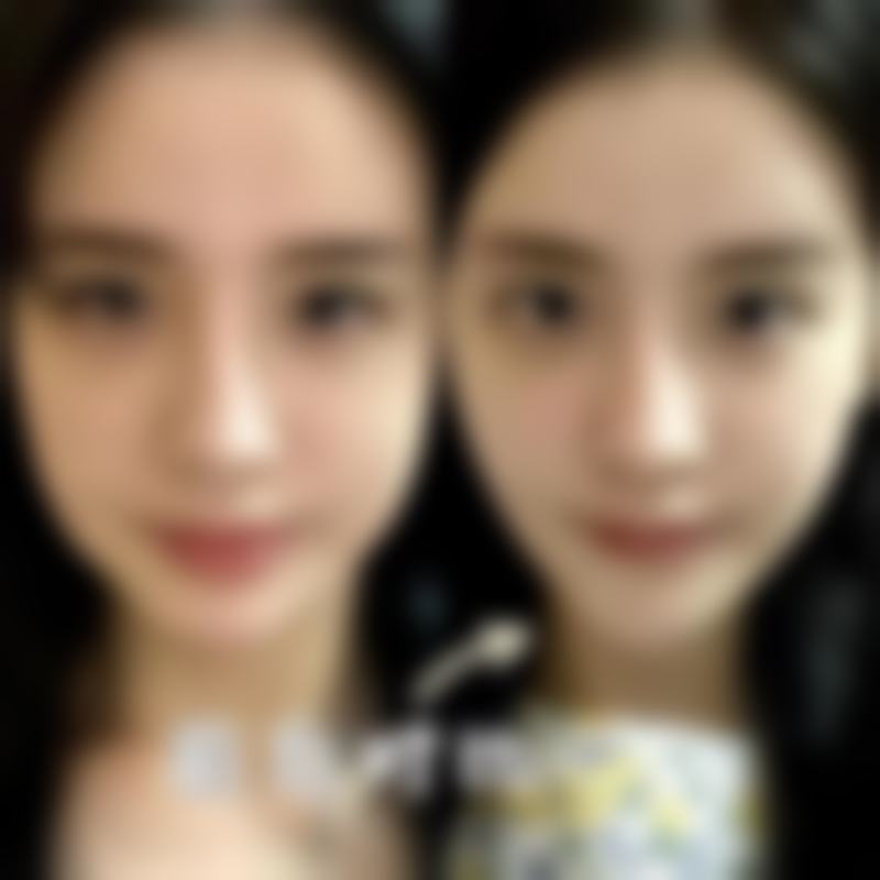 李炳乾医生真实实例