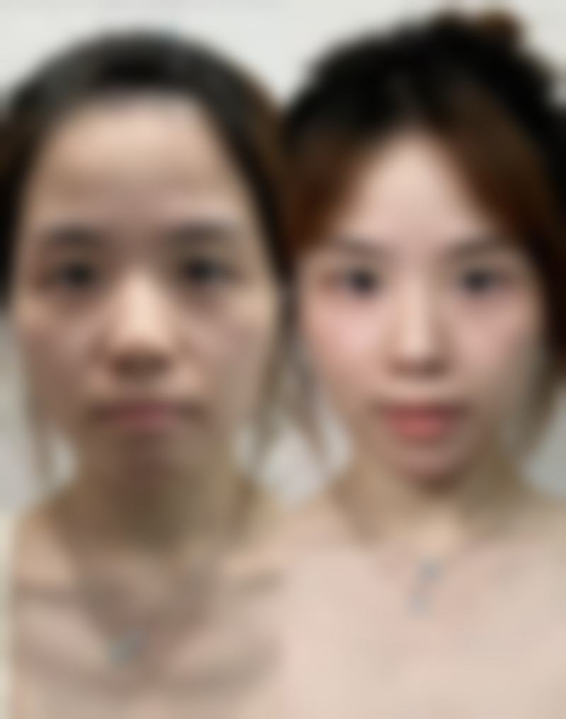 山西太原立仁激光整形医院口碑怎么样