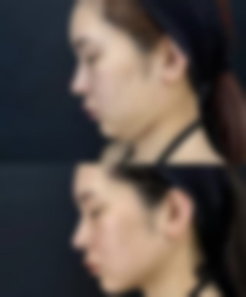 朱台航医生技术特点