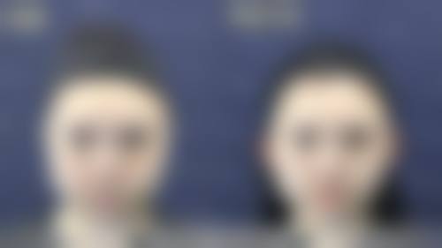 西安沐森植发医疗美容诊所真实实例