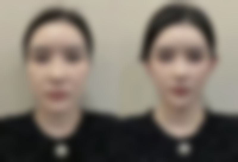 叶兰医生真实实例