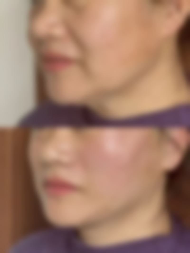 南通臻瑷美整形医院口碑怎么样
