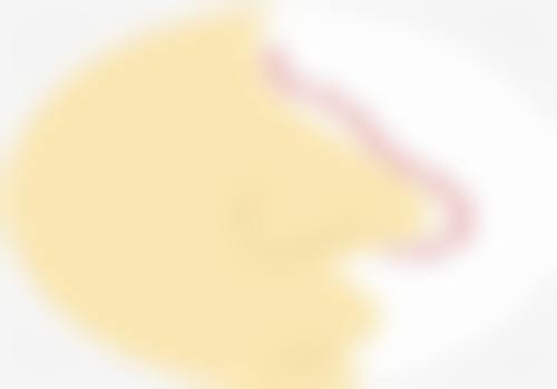 十几年的烫伤疤痕修复适合用激光治疗吗