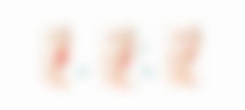 外切双眼皮修复完全自然后成效怎么样