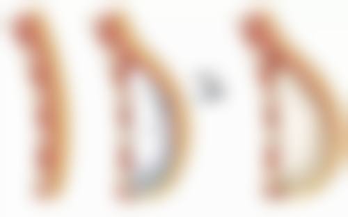 妙桃隆胸能让你自信满满是真的吗