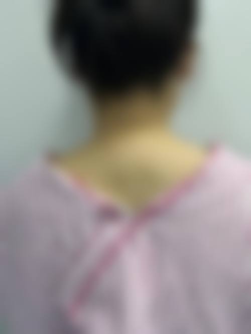 承德如玉医疗美容门诊部真实实例