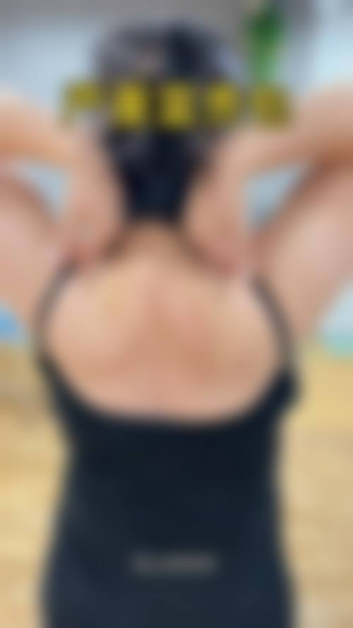 哈尔滨李翔整形医院真实实例