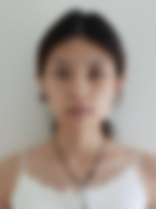 福州荟合肤浅美容皮肤科诊所口碑怎么样