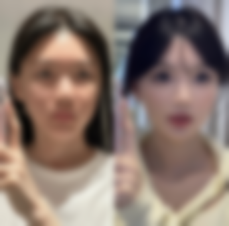 用牙签划出双眼皮坚持1 - 2个月真能有初步成效吗