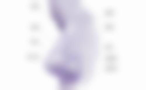 胸口长疤痕疙瘩怎么去除？医美微晶磨皮、激光祛疤等方法，还你光滑美胸，恢复自信！ 