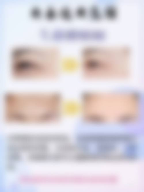 吴玛丽医生擅长项目