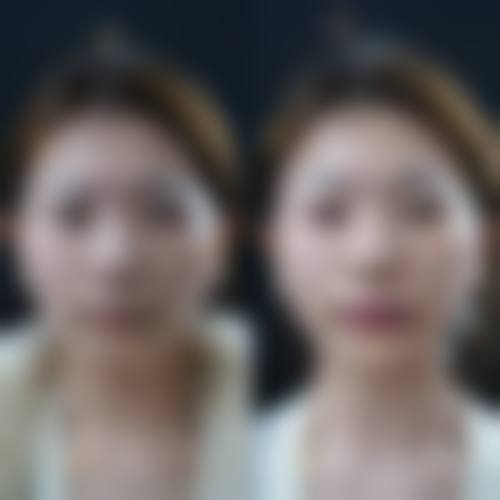 盐城美亿医疗美容门诊部价格表