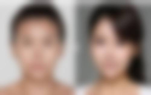 如何选择哺乳后隆胸的医院和医生