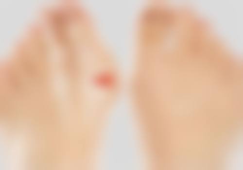 刘梅医师的真实实例
