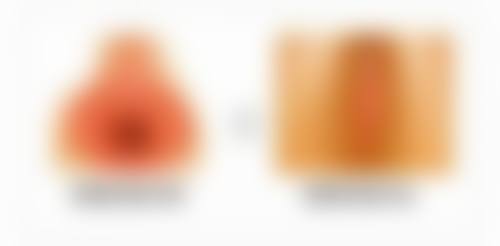 刘梅医师的技术特点