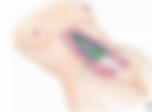 隆胸手术成效显著吗?