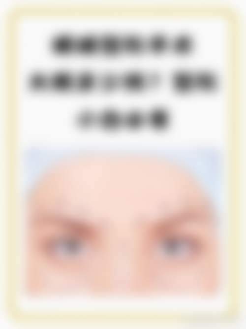 李志超