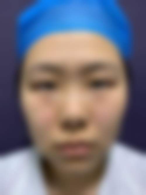 李志超医生擅长项目