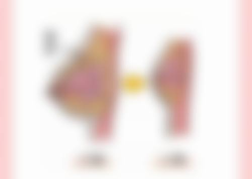 肋骨隆鼻定型后成效能维持多久