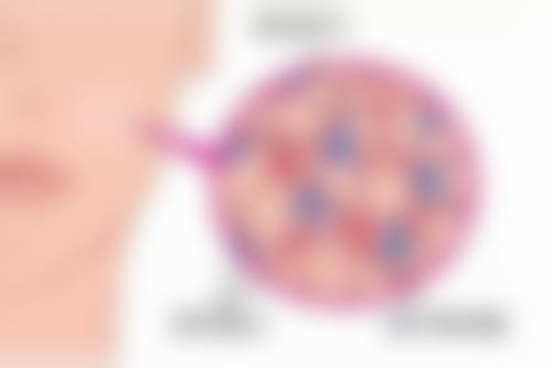 哪些因素会影响祛痣疤痕的修复时间?