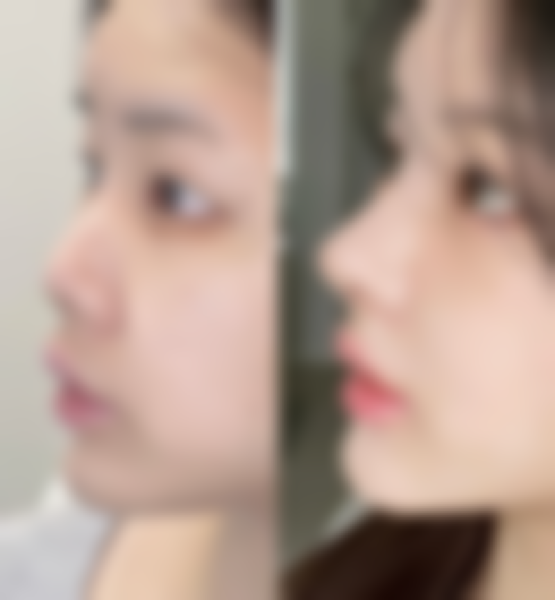 辜美山医生真实实例