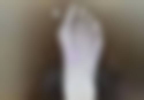 郭华峰医生看诊优势