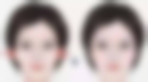 如何降低肚子吸脂风险