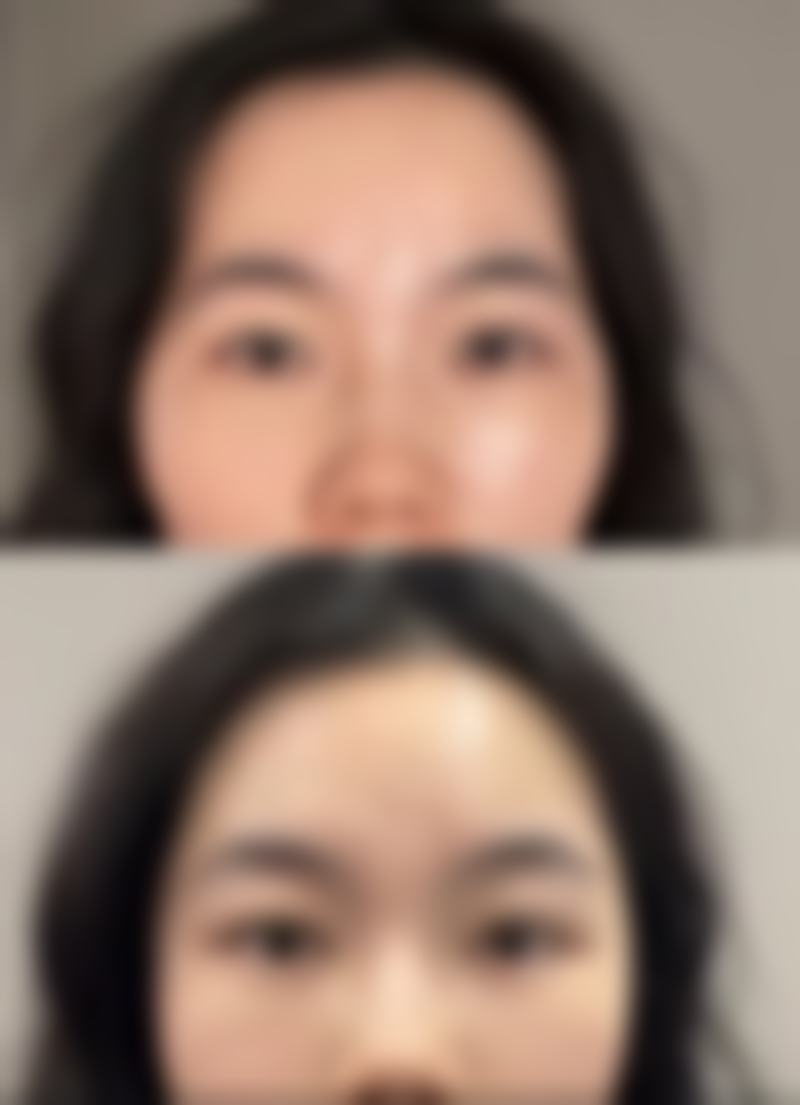 选择这个层次做假体隆胸手感值不值