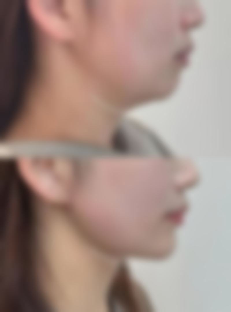金振吴医生的技术特点