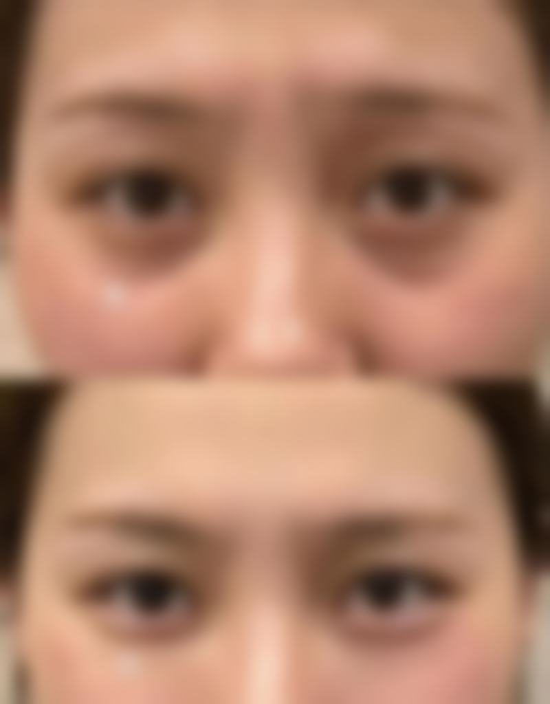 金子英真实实例