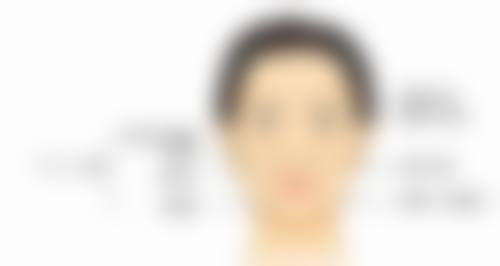 如何避免埋线双眼皮太宽