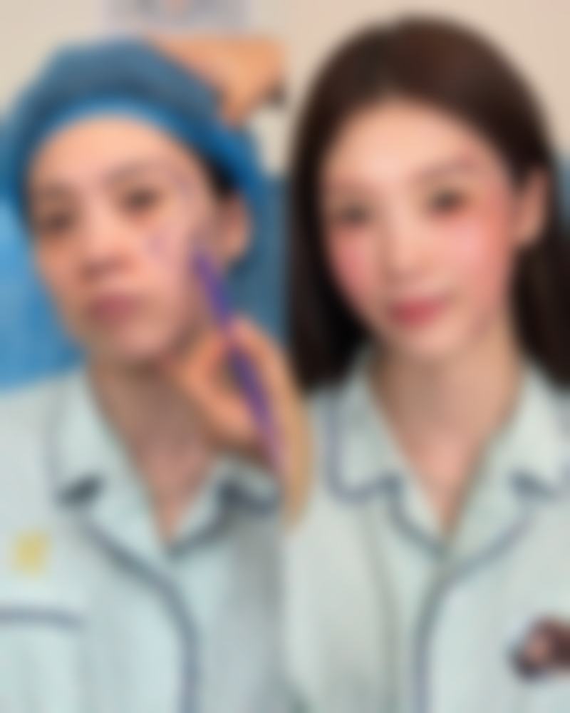 黄朝帅医生真实实例：见证美丽蜕变