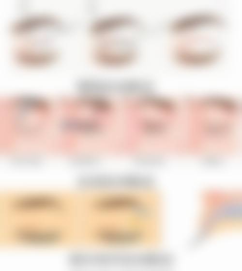 点痣后留下的疤痕怎么修复？分享3种有效医美方法，让你的肌肤重焕光滑！ 