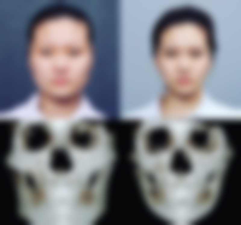 郯城杜文医生真实实例
