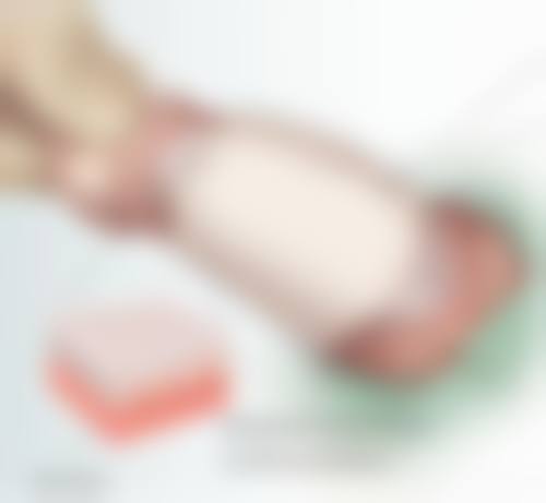 隆胸手术包膜挛缩后遗症怎么样