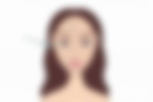 隆胸手术假体移位后遗症值不值