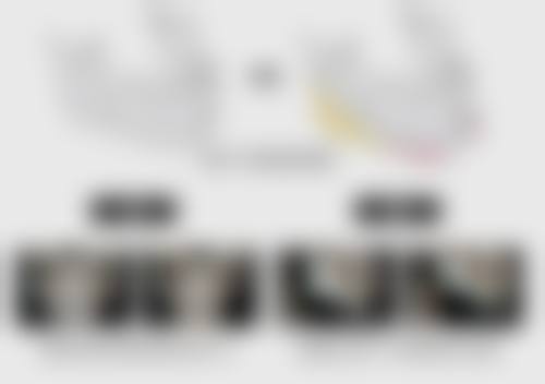 光子嫩肤治疗疤痕适合所有人吗