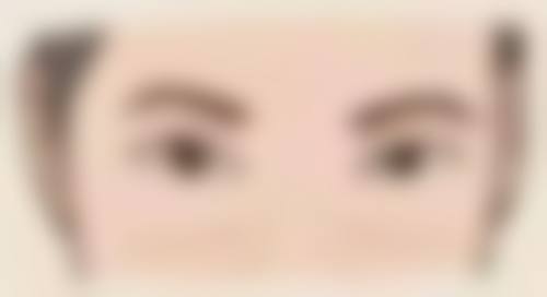做完眼袋泪沟填充注意什么？牢记术后护理 7 大要点，助你快速恢复美丽容颜！ 