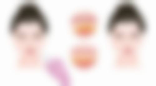 割双眼皮忌嘴忌多少天？一般术后1 - 3个月都需忌嘴，这些食物千万别碰！