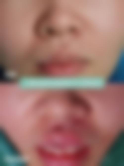 绵阳肤健皮肤专科门诊部真实实例