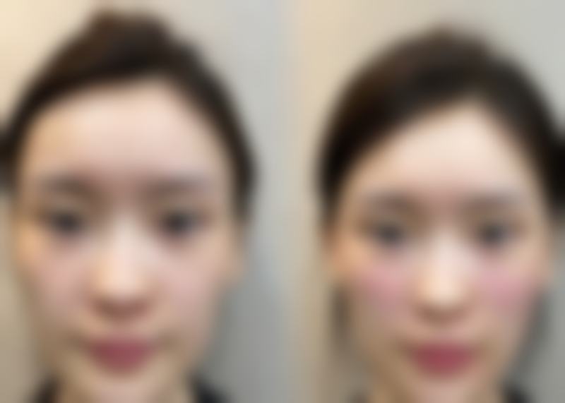 九江学院附属医院整形美容科真实实例