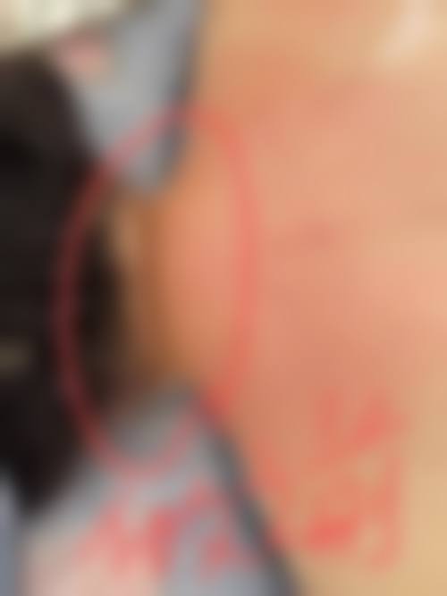 成都熙之环亚医疗美容医院价格表